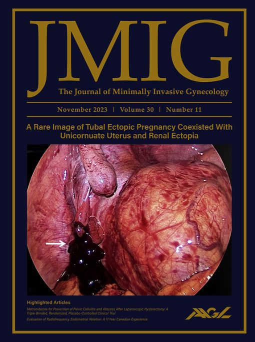 Journal of Minimally Invasive Gynecology: Volume 30 (Issue 1 to Issue 12) 2023 PDF