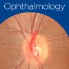 Ophthalmology: Volume 130 (Issue 1 to Issue 12) 2023 PDF