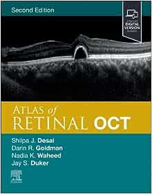 Atlas of Retinal OCT: Optical Coherence Tomography, 2nd edition (PDF)