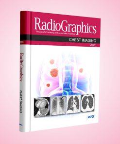 Radiographics Chest Imaging 2023