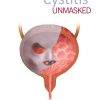 Cystitis unmasked (PDF)