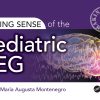 Making Sense of the Pediatric EEG (ePub Book)