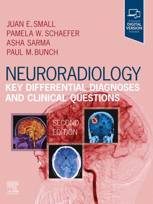 Neuroradiology: Key Differential Diagnoses and Clinical Questions, 2nd edition (PDF)