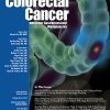 Clinical Colorectal Cancer: Volume 22 (Issue 1 to Issue 4) 2023 PDF