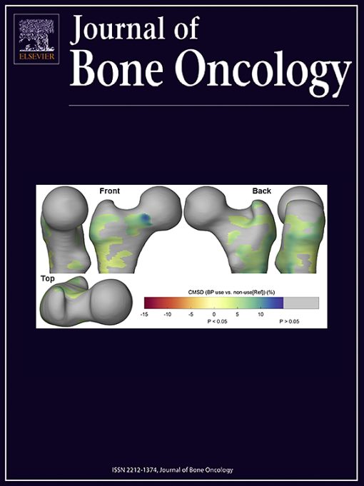 Journal of Bone Oncology: Volume 32 to Volume 37 2022 PDF