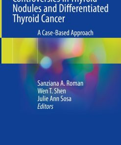 Controversies in Thyroid Nodules and Differentiated Thyroid Cancer (PDF Book)