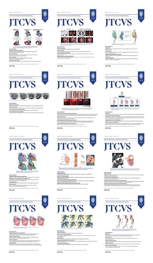 The Journal of Thoracic and Cardiovascular Surgery 2023 Full Archives (True PDF)