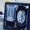 University of Washington Emergency Radiology Review 2023