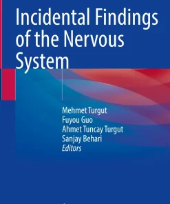 Incidental Findings of the Nervous System – E-Book – Original PDF