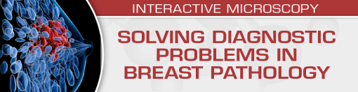 Solving Diagnostic Problems In Breast Pathology