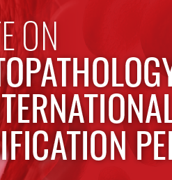Update On Hematopathology Classification: The International Consensus Classification Perspective 2023