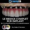 LearnyLib Le Bridge Complet sur Implant – Dada, Pariente de la plantification a la maintenance (Dental course)