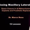 Missing Maxillary Lateral Incisors: Space Closure in all Malocclusions vs Implants and Prosthetic Replacement (Dental course)