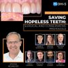 OHI-S Saving Hopeless Teeth, Surgical and Conservative Protocols (Dental course)