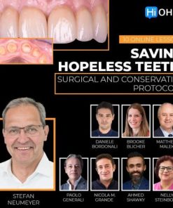 OHI-S Saving Hopeless Teeth, Surgical and Conservative Protocols (Dental course)