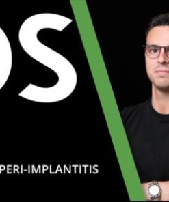Osteocom Unfolding Peri-Implantitis – Alberto Monje