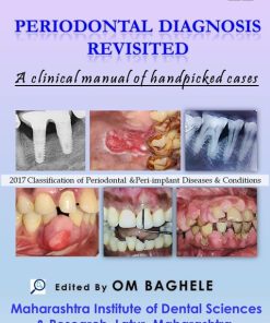 Periodontal Diagnosis Revisited: A Clinical Manual of Handpicked Cases (PDF Convent)