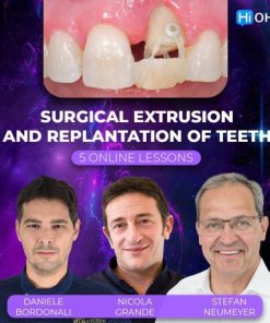 OHI-S Surgical Extrusion and Replantation of Teeth (Dental course)