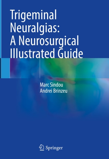 Trigeminal Neuralgias A Neurosurgical Illustrated Guide.jpg