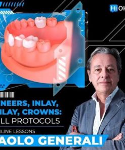 Veneers, Inlay, Onlay, Crowns: Full Protocols (Dental course)