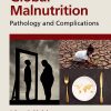 Global Malnutrition: Pathology And Complications (PDF)