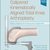 Calipered Kinematically Aligned Total Knee Arthroplasty: Theory, Surgical Techniques And Perspectives (EPUB)