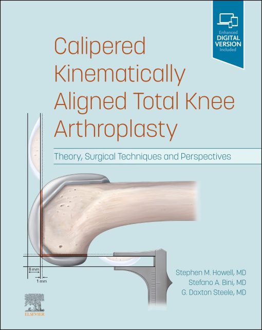 Calipered Kinematically Aligned Total Knee Arthroplasty: Theory, Surgical Techniques And Perspectives (EPUB)