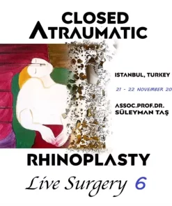 Closed Atraumatic Rhinoplasty Live Surgery DVD 6