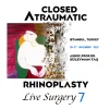 Closed Atraumatic Rhinoplasty Live Surgery DVD 7 (2 Cases: Rhinoplasty + FaceLift & NeckLift)
