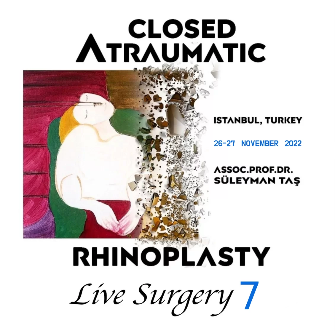 Closed Atraumatic Rhinoplasty Live Surgery DVD 7 (2 Cases: Rhinoplasty + FaceLift & NeckLift)
