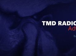 TMD Radiology Advanced – Master Level Webinars – Lukasz Lassmann (Master of TMD and FMR)