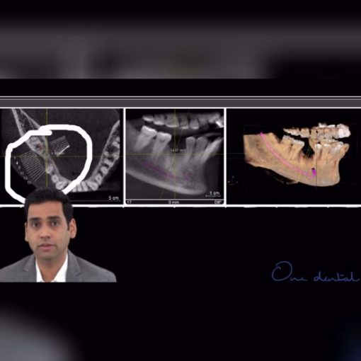 CBCT assisted dentistry