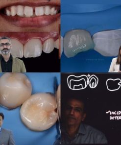 Direct restorative dentistry