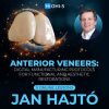 Ohi-s Anterior Veneers: Digital Manufacturing Protocols for Functional and Aesthetic Restorations 