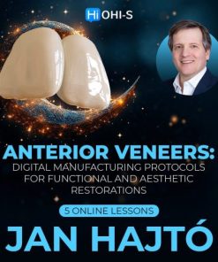 Ohi-s Anterior Veneers: Digital Manufacturing Protocols for Functional and Aesthetic Restorations 