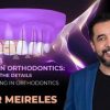 OHI-S Finishing in orthodontics: aesthetics in the details – Kleber Meireles
