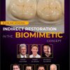 Indirect restoration in the biomimetic concept
