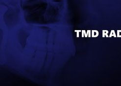 TMD Radiology Basic – Master Level Webinars – Lukasz Lassmann (Master of TMD and FMR)