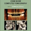 Interpretation Basics Of Cone Beam Computed Tomography, 2nd Edition (PDF)