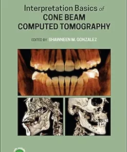 Interpretation Basics Of Cone Beam Computed Tomography, 2nd Edition (PDF)