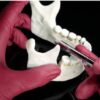 Exodontia Comprehensive Oral Surgery – Jason Hoium Module 1-13