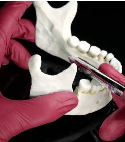 Exodontia Comprehensive Oral Surgery – Jason Hoium Module 1-13