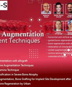 Bone Augmentation, Current Techniques
