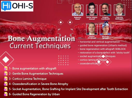 Bone Augmentation, Current Techniques
