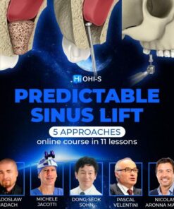 OHI-S Predictable Sinus Lift