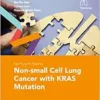 Fast Facts For Patients: Non-Small Cell Lung Cancer With KRAS Mutation (PDF)