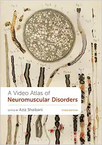 A Video Atlas Of Neuromuscular Disorders (PDF Book)