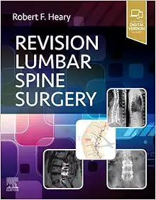 Revision Lumbar Spine Surgery (EPUB)