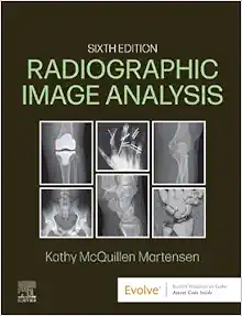 Radiographic Image Analysis, 6th Edition (EPUB)
