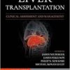 Liver Transplantation: Clinical Assessment And Management, 2nd Edition (EPUB)